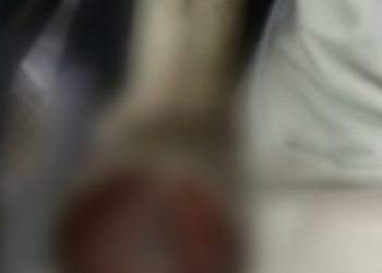 Vídeo: moedor de carne suga braço de açougueiro no supermercado