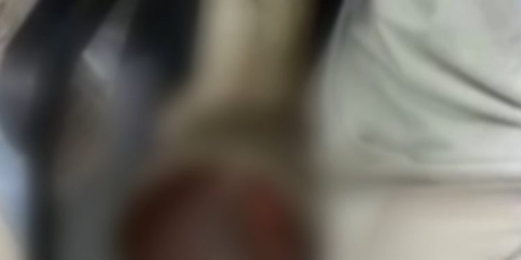 Vídeo: moedor de carne suga braço de açougueiro no supermercado