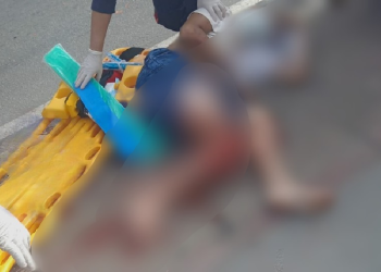 Carro ating3 motociclista e ele fica no chão com fr@tura exposta em Manaus