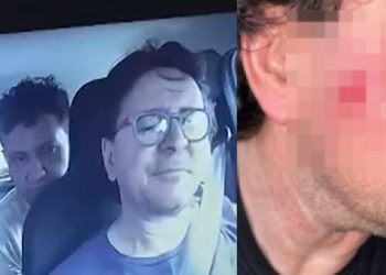 Vídeo: motorista da Uber agredid0 por passageiro com facã0 feriu rosto, mão e cabeça
