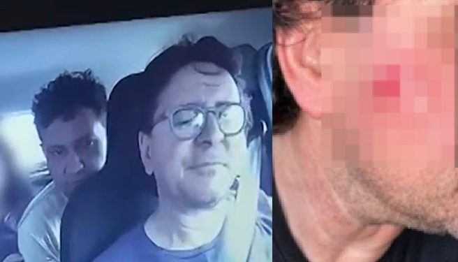 Vídeo: motorista da Uber agredid0 por passageiro com facã0 feriu rosto, mão e cabeça