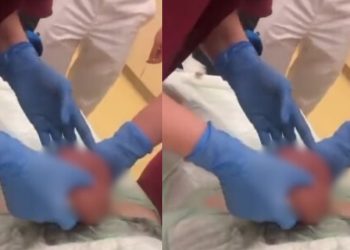 Vídeo: homem é operad0 após ter os 0v0s algemados pela esposa 