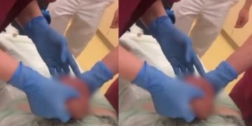 Vídeo: homem é operad0 após ter os 0v0s algemados pela esposa 