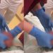 Vídeo: homem é operad0 após ter os 0v0s algemados pela esposa 