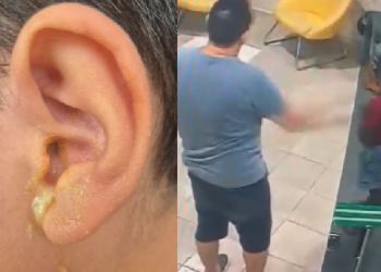 Vídeo: Menino de 8 anos tem tímpano p3rfurad0 por servidor do TJAM em Manaus