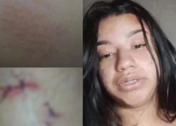Vídeo: Jovem de 22 anos denuncia o ex e a família dele por agressã0 em Manaus: ‘na frente da minha filha’