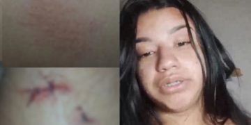 Vídeo: Jovem de 22 anos denuncia o ex e a família dele por agressã0 em Manaus: ‘na frente da minha filha’
