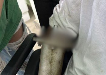 Veja o vídeo: Açougueiro fica fer1do após mão ser sugada por máquina de moer carne