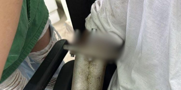 Veja o vídeo: Açougueiro fica fer1do após mão ser sugada por máquina de moer carne