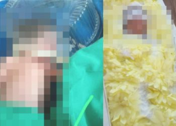 Menino prematuro é colocado em tampa de bolo e m0rre no Amazonas