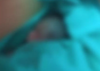 Morre recém-nascido de família do AM que foi retirado vivo do próprio velório