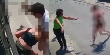 Homem deixa namorada com fac@ nas costas e foge para não ser pres0 