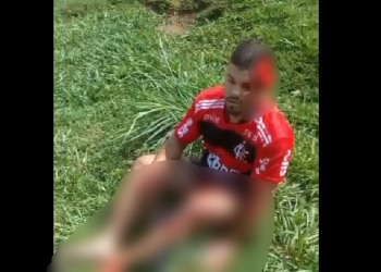 Vídeo mostra motociclista com a cabeça ab3rta após ser atingido por picape em Manacapuru; veja
