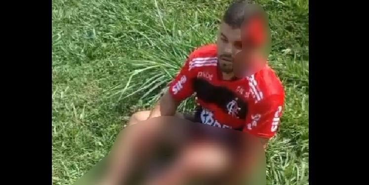Vídeo mostra motociclista com a cabeça ab3rta após ser atingido por picape em Manacapuru; veja