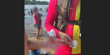 Ataques de piranhas transformam dia de lazer em cenário de t3rr0r em balneário de Manacapuru