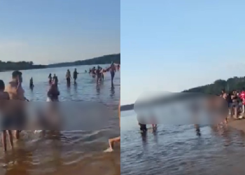 Bebê de 7 meses teve parte do dedo arr@ncad0 por p1ranhas no Balneário do Miriti