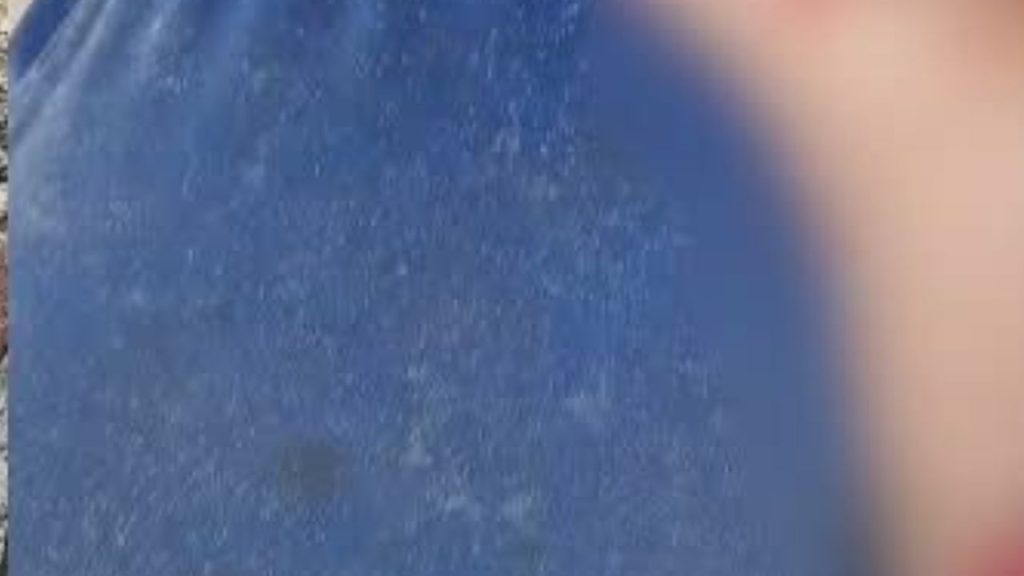 Homem aparece em hospital de Maués com uma das mãos d3cep4da; VEJA