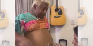 Após melhoria nos dentes, Patixa quer diminuir o bucho