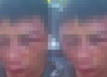 Imagem forte: jovem tem rosto desfigurad0 pelo vizinho em Manaus