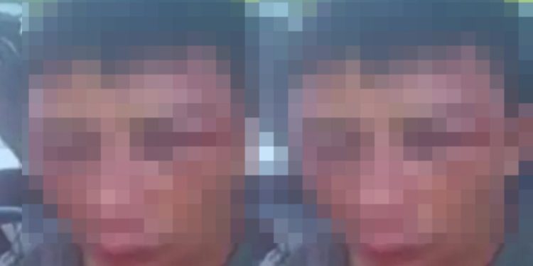 Imagem forte: jovem tem rosto desfigurad0 pelo vizinho em Manaus
