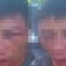 Imagem forte: jovem tem rosto desfigurad0 pelo vizinho em Manaus