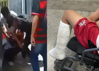 Falsa denúncia faz garoto de 13 anos ter a p3rna qu3brada por cinco estudantes em Manaus