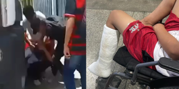 Falsa denúncia faz garoto de 13 anos ter a p3rna qu3brada por cinco estudantes em Manaus