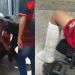 Falsa denúncia faz garoto de 13 anos ter a p3rna qu3brada por cinco estudantes em Manaus