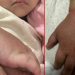 Menina de 2 anos quase perde braço por prender elástico de cabelo no braço em Manaus 