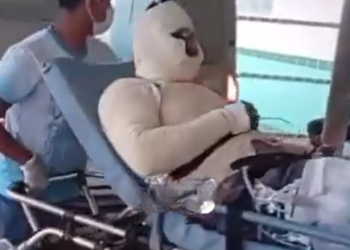 Operador sofre queimaduras graves em explosão em usina de asfalto e qu3da de 5 metros em Itacoatiara