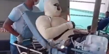 Operador sofre queimaduras graves em explosão em usina de asfalto e qu3da de 5 metros em Itacoatiara