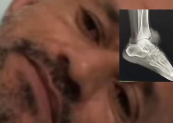 Trabalhador acusa policiais de atir4r nele durante ação no interior do AM; vídeo