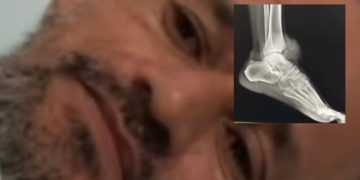 Trabalhador acusa policiais de atir4r nele durante ação no interior do AM; vídeo