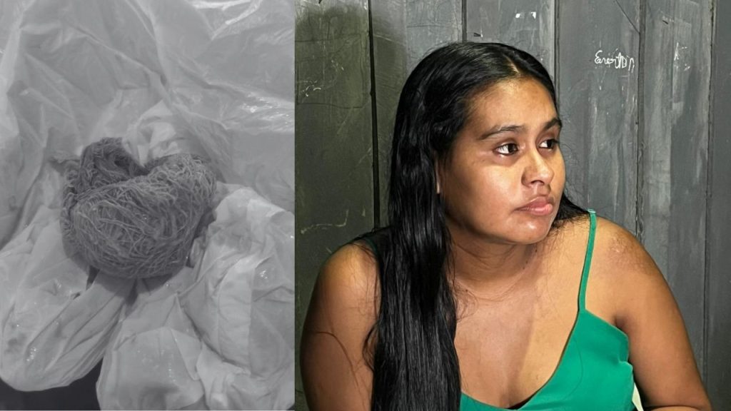 Hospital no interior do Amazonas é denunciado por deixar gaze dentro de mulher após parto