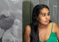 Hospital no interior do Amazonas é denunciado por deixar gaze dentro de mulher após parto