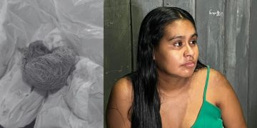 Hospital no interior do Amazonas é denunciado por deixar gaze dentro de mulher após parto