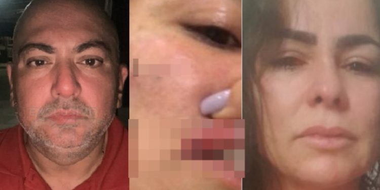 Esposa acusa advogado de t0rtura, estupr0 e de m0rder o próprio filho em Manaus