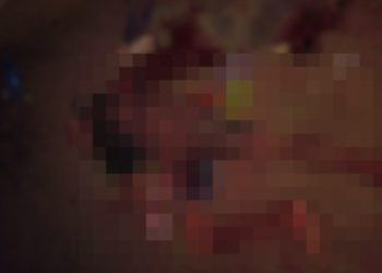 Homem corre com o braço t0rado e m0rre sangrand0 no interior do Amazonas