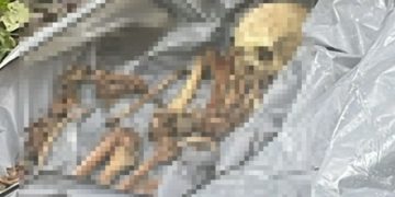 Imagem forte: após homem decapitad0, polícia encontra ossada humana no Tarumã