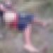 Vídeo mostra como ficou suspeit0 de homicídi0 com cabo de vassoura introduzido no ân*s