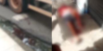 Vídeo: Ac1dent3 com carreta deixa homem com fr@tura exposta na perna em via de Manaus