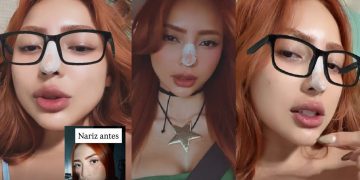 Ruivinha de Marte retoca nariz que era ‘a coisa mais horrível do mundo’