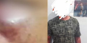 Homem é preso após agr3d1r companheira e deixá-la com olho r0x0 em Barreirinha