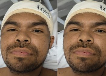 Serviço Social do João Lúcio tenta encontrar familiares de paciente agr3dido em Manaus