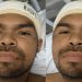 Serviço Social do João Lúcio tenta encontrar familiares de paciente agr3dido em Manaus