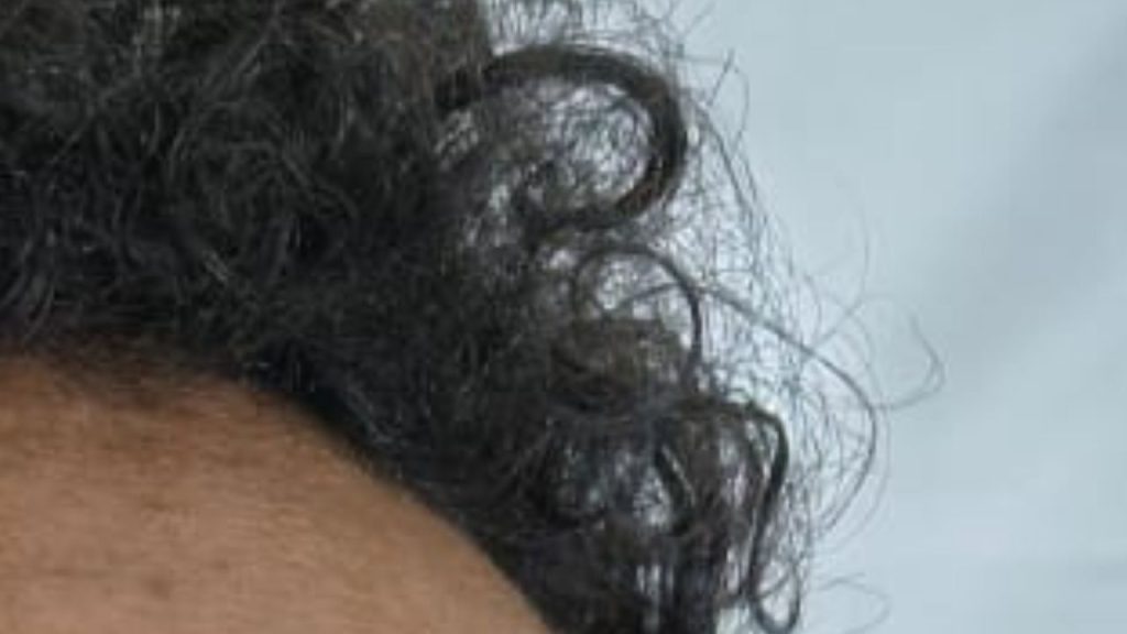 Paciente internado desde novembro no João Lúcio aguarda contato da família