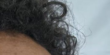 Paciente internado desde novembro no João Lúcio aguarda contato da família