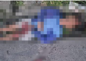 Homem é balead0 quatro vezes em Manaus e mesmo assim não m0rre