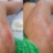 Mulher pede o divórcio e marido passa caminhão por cima da perna dela no Amazonas