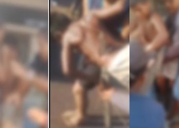 Vídeo forte: menino vai pular cerca para pegar papagaio e fica com madeira cravada no corpo